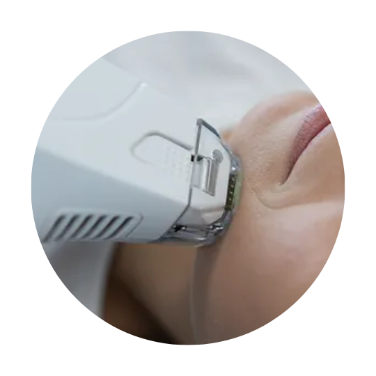 Invisalign